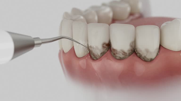 Reliable Teeth Cleaning And Checkup contractor in Sanborn County County, SD by Dentist Open Now